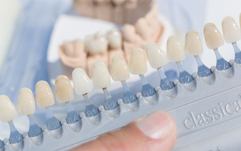 A person is holding a set of teeth in front of them for teeth whitening purposes.