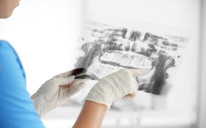 A dentist holding up an x - ray of a patient's teeth.